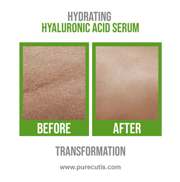 Hyaluronic Acid Hydrating Serum