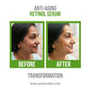 Anti-Aging Retinol Serum