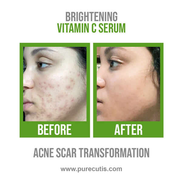 Vitamin C Brightening Serum