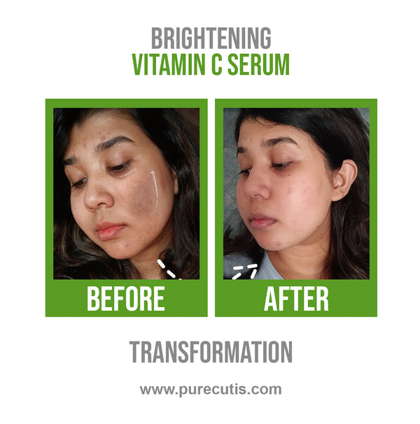 Vitamin C Brightening Serum